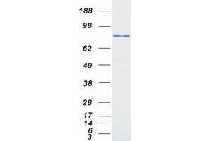 Validation with Western Blot