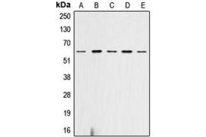 Western blot analysis of AKT (pS473) expression in HeLa (A), SP2/0 (B), mouse heart (C), rat heart (D), rat liver (E) whole cell lysates. (AKT1 anticorps  (C-Term, pSer473))