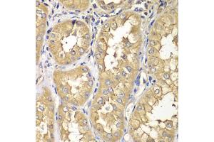 Immunohistochemistry of paraffin-embedded human kidney using RAB5C antibody (ABIN5975504) at dilution of 1/100 (40x lens). (Rab5c anticorps)