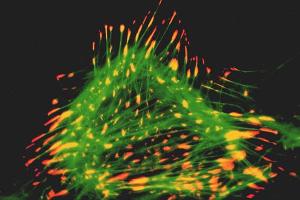 Immunocytochemical staining of a rat cardiac fibroblast using anti-Lipoma Preferred Partner, pAb (IG-817)  (LPP; red fluorescence) and a green-fluorescent phalloidin derivative staining filamentous actin.