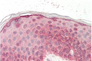 ABIN5539508 (5µg/ml) staining of paraffin embedded Human Skin. (EGF anticorps  (Internal Region))