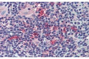 Detection of PDL2 in Mouse Spleen Tissue using Polyclonal Antibody to Programmed Cell Death Protein 1 Ligand 2 (PDL2) (PDCD1LG2 anticorps  (AA 36-219))