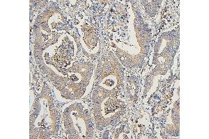 IHC analysis of COPE using anti-COPE antibody (ABIN7602509). (COPE anticorps  (AA 80-308))