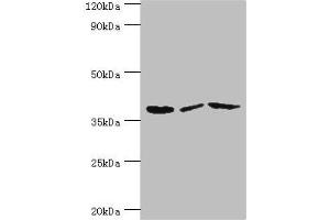 Western blot All lanes: P2RY14 antibody at 12 μg/mL Lane 1: Mouse heart tissue Lane 2: Mouse stomach tissue Lane 3: Mouse small intestine tissue Secondary Goat polyclonal to rabbit IgG at 1/10000 dilution Predicted band size: 39 kDa Observed band size: 39 kDa