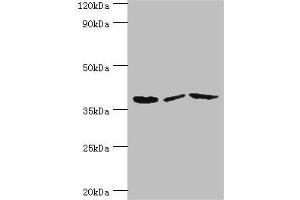 Western blot All lanes: P2RY14 antibody at 12 μg/mL Lane 1: Mouse heart tissue Lane 2: Mouse stomach tissue Lane 3: Mouse small intestine tissue Secondary Goat polyclonal to rabbit IgG at 1/10000 dilution Predicted band size: 39 kDa Observed band size: 39 kDa (P2RY14 anticorps  (AA 209-338))