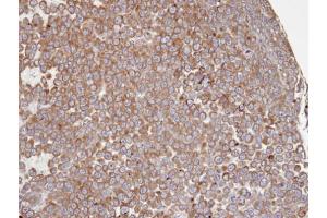 IHC-P Image Immunohistochemical analysis of paraffin-embedded PC13 xenograft, using PTGS1 , antibody at 1:100 dilution.