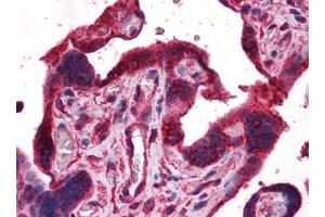 Human Placenta: Formalin-Fixed, Paraffin-Embedded (FFPE) (DPP8 anticorps)