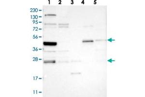 Western blot analysis of Lane 1: RT-4, Lane 2: U-251 MG, Lane 3: Human Plasma, Lane 4: Liver, Lane 5: Tonsil with SMAP2 polyclonal antibody . (SMAP2 anticorps)
