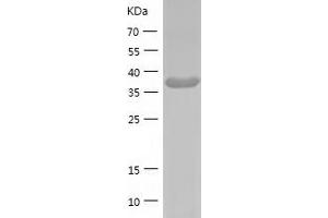 Western Blotting (WB) image for GDP-Mannose 4,6-Dehydratase (GMDS) (AA 1-372) protein (His-IF2DI Tag) (ABIN7123070)
