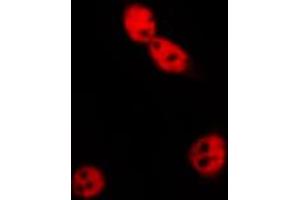 ABIN6269196 staining MCF7 by IF/ICC.