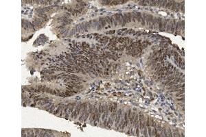 IHC analysis of FOXP1 using anti-FOXP1 antibody (ABIN7602780). (FOXP1 anticorps  (C-Term))