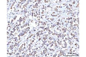 IHC analysis of C18orf22/RBFA using anti-C18orf22/RBFA antibody (ABIN7600106). (RBFA anticorps  (AA 15-319))