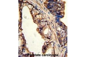 Immunohistochemistry (IHC) image for anti-Transglutaminase 4 (Prostate) (TGM4) antibody (ABIN3002879) (TGM4 anticorps)