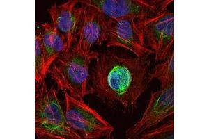 Immunofluorescence analysis of Hela cells using MMP1 mouse mAb (green).