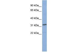 WB Suggested Anti-SNAPC2 Antibody Titration: 0. (SNAPC2 anticorps  (N-Term))