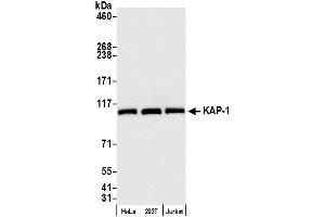 Western Blotting (WB) image for anti-Tripartite Motif Containing 28 (TRIM28) (AA 1-50) antibody (ABIN7455078) (KAP1 anticorps  (AA 1-50))