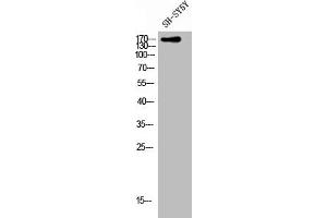 Western Blot analysis of SH-SY5Y cells using CLASP1 Polyclonal Antibody (CLASP1 anticorps  (C-Term))