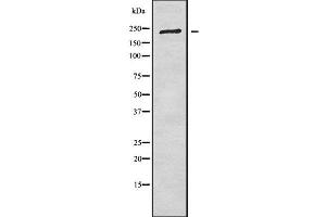 Western blot analysis of CROCC using COLO205 whole cell lysates (CROCC anticorps  (N-Term))