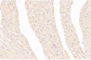 Immunohistochemistry analysis of paraffin-embedded rat heart using,CA5A (ABIN7073309) at dilution of 1: 3000