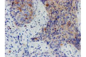 Image no. 1 for anti-Myoneurin (MYNN) (AA 10-300) antibody (ABIN1490790)