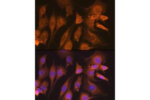 Immunofluorescence analysis of NIH-3T3 cells using Guanylyl Cyclase beta 1 (GUCY1B3) (GUCY1B3) Rabbit mAb (ABIN7267551) at dilution of 1:100 (40x lens).