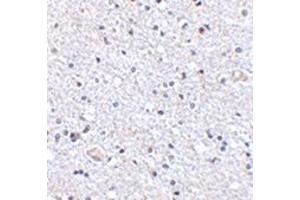 Immunohistochemistry of TSLP in human brain tissue with this product at 2. (Thymic Stromal Lymphopoietin anticorps  (Center))