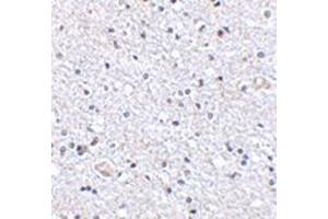 Immunohistochemistry of TSLP in human brain tissue with this product at 2. (Thymic Stromal Lymphopoietin anticorps  (Center))