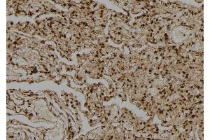 ABIN6274039 at 1/100 staining Human lung tissue by IHC-P. (PPP1CA + 1CB anticorps)