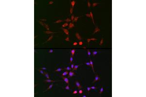 Immunofluorescence analysis of BALB-3T3 cells using LOX Rabbit pAb (ABIN6133805, ABIN6143288, ABIN6143289 and ABIN6223629) at dilution of 1:100 (40x lens). (LOX anticorps)