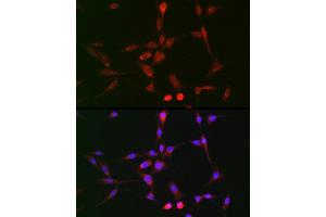 Immunofluorescence analysis of BALB-3T3 cells using LOX Rabbit pAb (ABIN6133805, ABIN6143288, ABIN6143289 and ABIN6223629) at dilution of 1:100 (40x lens).