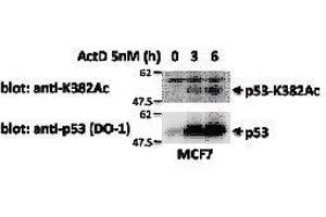 Western Blotting (WB) image for anti-Tumor Protein P53 (TP53) (acLys382) antibody (ABIN3201008) (p53 anticorps  (acLys382))