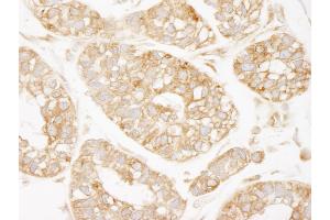 Immunohistochemistry (IHC) image for anti-Lysyl-tRNA Synthetase (KARS) (C-Term) antibody (ABIN7448981) (KARS anticorps  (C-Term))