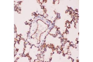 Anti-ACE Picoband antibody,  IHC(P): Rat Lung Tissue