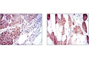Immunohistochemistry (IHC) image for anti-Ribosomal Protein S6 Kinase, 70kDa, Polypeptide 1 (RPS6KB1) antibody (ABIN1108904)