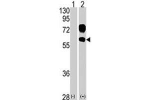 KREMEN1 anticorps  (N-Term)