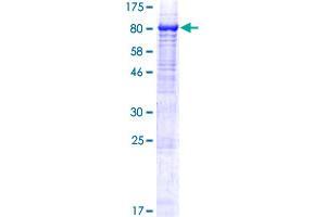 Image no. 1 for Chromosome 1 Open Reading Frame 84 (C1orf84) (AA 1-579) protein (GST tag) (ABIN1308575)