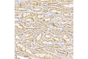 Immunohistochemistry of paraffin-embedded human liver using STING/TMEM173 Rabbit pAb (ABIN1683049, ABIN3017833, ABIN3017834 and ABIN6220283) at dilution of 1:50 (40x lens). (STING/TMEM173 anticorps  (AA 170-379))