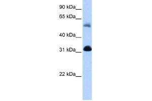 OXCT1 antibody used at 0. (OXCT1 anticorps  (N-Term))