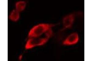ABIN6275107 staining MCF7 cells by IF/ICC. (ELOVL5 anticorps  (C-Term))