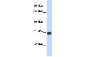 WB Suggested Anti-ZMYND19 Antibody Titration:  0. (ZMYND19 anticorps  (Middle Region))