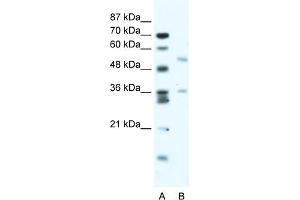 WB Suggested Anti-BTBD3 Antibody Titration:  2. (BTBD3 anticorps  (Middle Region))