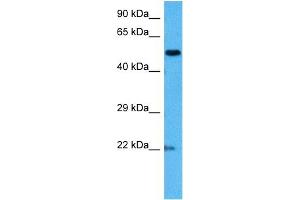 Host:  Mouse  Target Name:  MECP2  Sample Tissue:  Mouse Brain  Antibody Dilution:  1ug/ml (MECP2 anticorps  (N-Term))