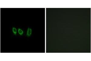 Immunofluorescence analysis of A549 cells, using CSTL1 Antibody. (CSTL1 anticorps  (AA 61-110))