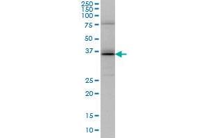 UBE2J1 monoclonal antibody (M01), clone 6A12 Western Blot analysis of UBE2J1 expression in HeLa .