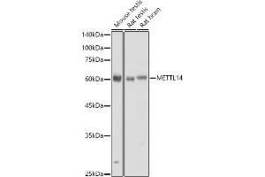 Western blot analysis of extracts of various cell lines, using METTL14 antibody (ABIN6131104, ABIN6143759, ABIN6143760 and ABIN6224625) at 1:730 dilution. (METTL14 anticorps  (AA 1-210))