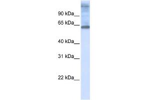 WB Suggested Anti-C3orf17 Antibody Titration:  0. (C3orf17 anticorps  (Middle Region))