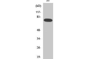 Western Blotting (WB) image for anti-Nuclear Factor-kB p65 (NFkBP65) (pSer468) antibody (ABIN5961221) (NF-kB p65 anticorps  (pSer468))