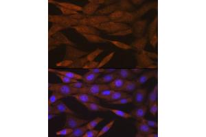 Immunofluorescence analysis of NIH-3T3 cells using PER2 Rabbit mAb (ABIN7269224) at dilution of 1:100 (40x lens).