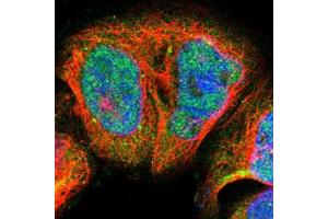 Immunofluorescent staining of A-431 cells with BLM polyclonal antibody  (Green) shows positivity in nucleus and cytoplasm. (BLM anticorps)