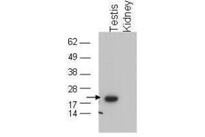 Western blot using  affinity purified anti-GPx4 to detect GPx4 in testis extract (arrow). (GPX4 anticorps  (C-Term))